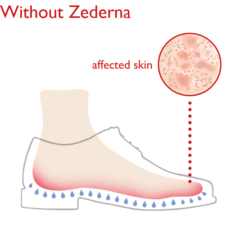 zederna insoles